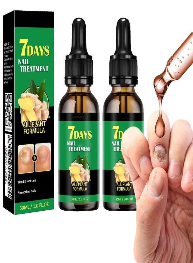 IMOLL Ginger Nail Treatment Nail Support Nail Care, 7days Nail Treatment, Ginger Nail Growth Serum, Ginger Cuticle Care Oil for Nails,Cuticle Serum for Nails (2Pcs, 1 Fl.oz(pack of 1)) - Image 1